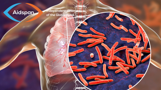 Rebounding against TB: challenges and prospects